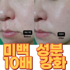◀ 2024년 인플들이 추천하는 가성비▶ 고혼진기미크림 추천 제품 리스트 9