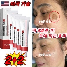 놓치면 후회할 기미크림 할인 아이템 상위 9