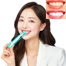가성비 치아미백 최저가 제품 베스트 5