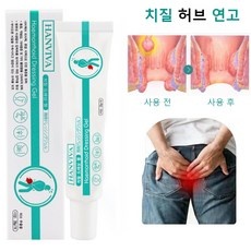 최저가 치핵 최저가 제품 TOP 9