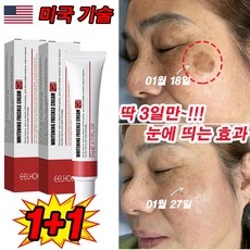 다시 사고 싶어요, 정말 좋아요. 기미 추천 상품 TOP 9