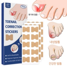 꼭 사세요, 후회하지 않아요. 내성발톱교정기파고드는 추천 정보 BEST 9