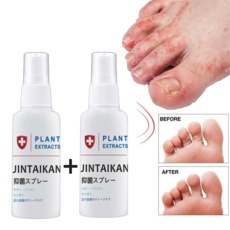 SNS 인기템이에요, 정말 좋아요. 발무좀 추천 정보 상위 9