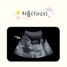 이건 필수품이에요, 정말 좋아요. 성장동영상제작 추천 제품 BEST 9