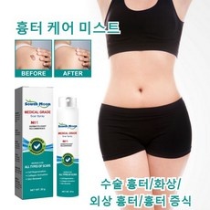 가격 대비 최고, 정말 좋아요. 흉터제거연고 인기 상품 상위 9