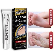 재구매 의사 있습니다, 정말 만족해요. 발바닥무좀약 인기 상품 탑 9