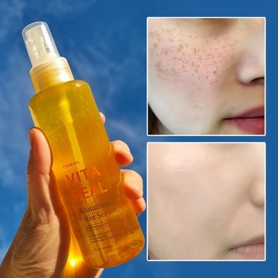 혜자템이에요, 만족스러워요. 오비톡스 추천 아이템 탑 8