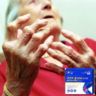 꼭 사세요, 후회하지 않아요. 탄탄관절보 할인 아이템 베스트 7